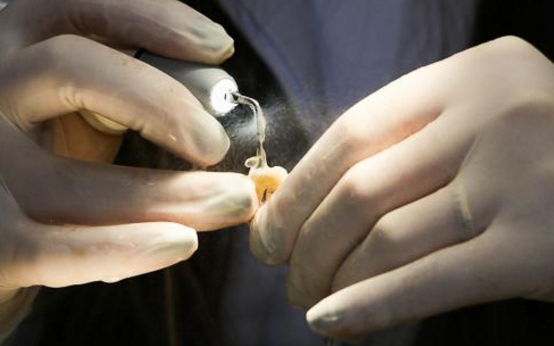 Curso de Especialização em Endodontia.Saiba Mais.